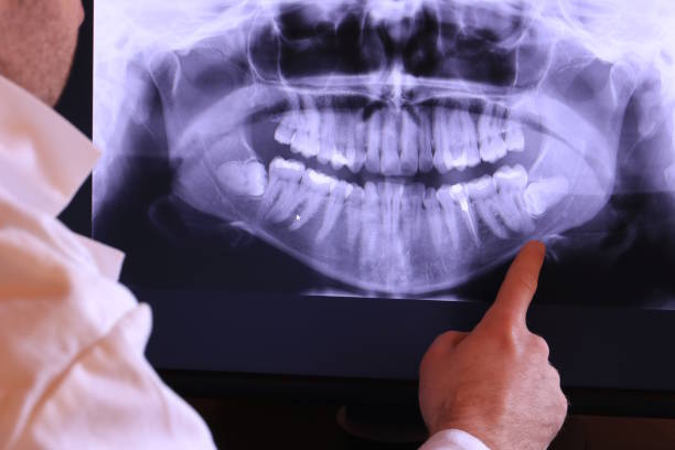Best Emergency Dental Care for Abscessed Tooth in Mableton, GA