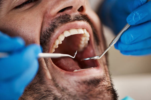 Best Pediatric Emergency Dentist in Mableton, GA