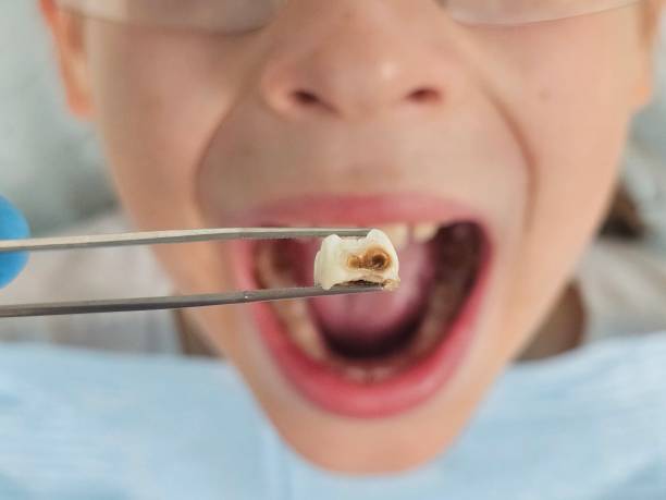 Best Emergency Cosmetic Dentistry in Mableton, GA